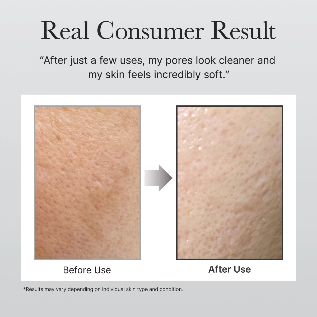 Arencia Black Tea Cleanser brand before and after consumer result image with results-may-vary footnote