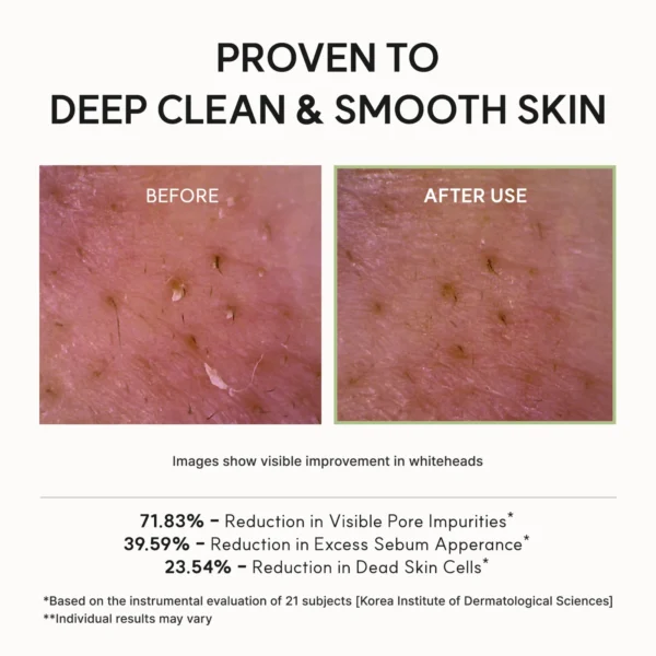 Arencia Fresh Green Cleanser clinical results: 71.83% reduction in visible pore impurities across 21 subjects