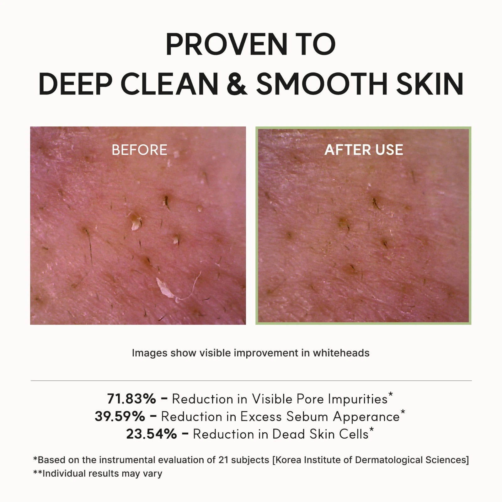 Arencia Fresh Green Cleanser clinical results: 71.83% reduction in visible pore impurities across 21 subjects