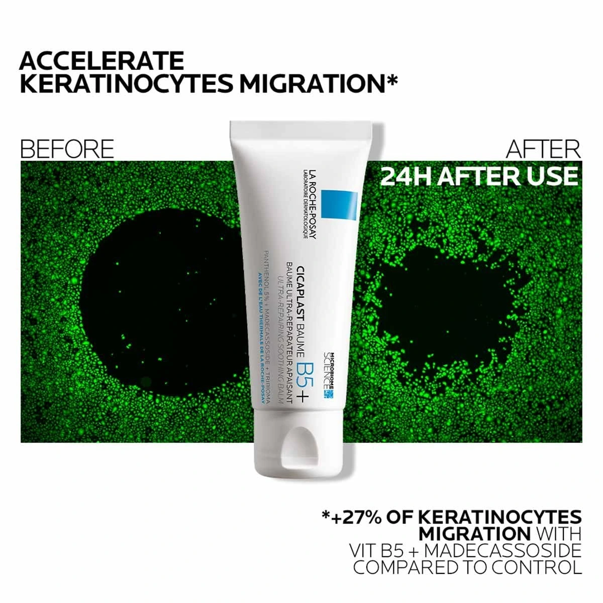 Cicaplast Baume B5 keratinocyte migration before and after visual