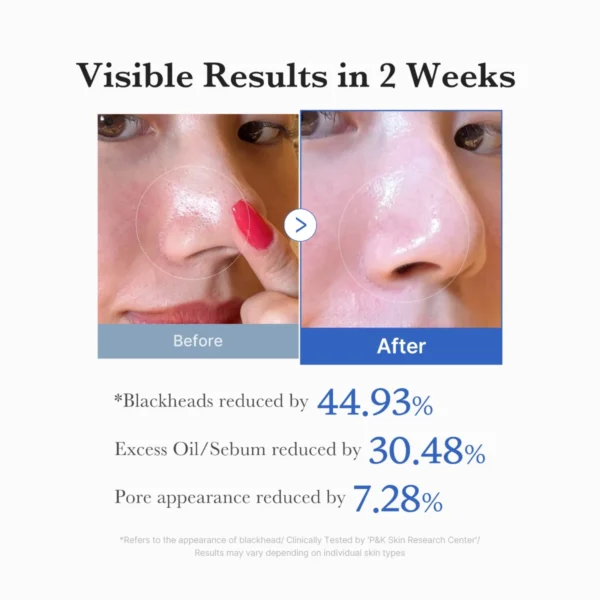 Skin close-up illustrating pore care results