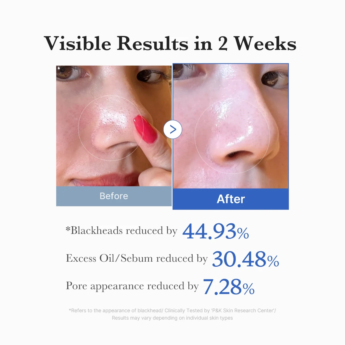 Skin close-up illustrating pore care results