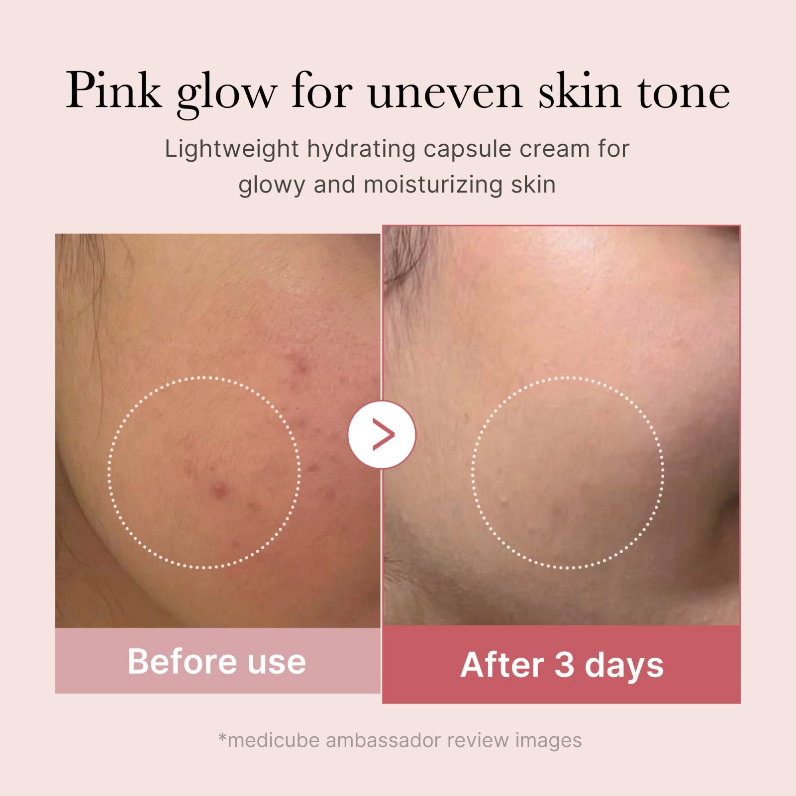 Mixing the capsule and gel portions of the Medicube Collagen Capsule Cream on the back of the hand